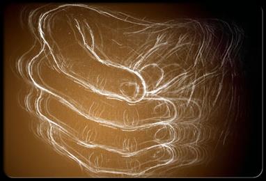 Person with Parkinson disease 