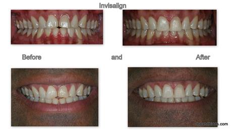 Dr Bhavin S Gandhi DDS Inc in Cerritos, CA